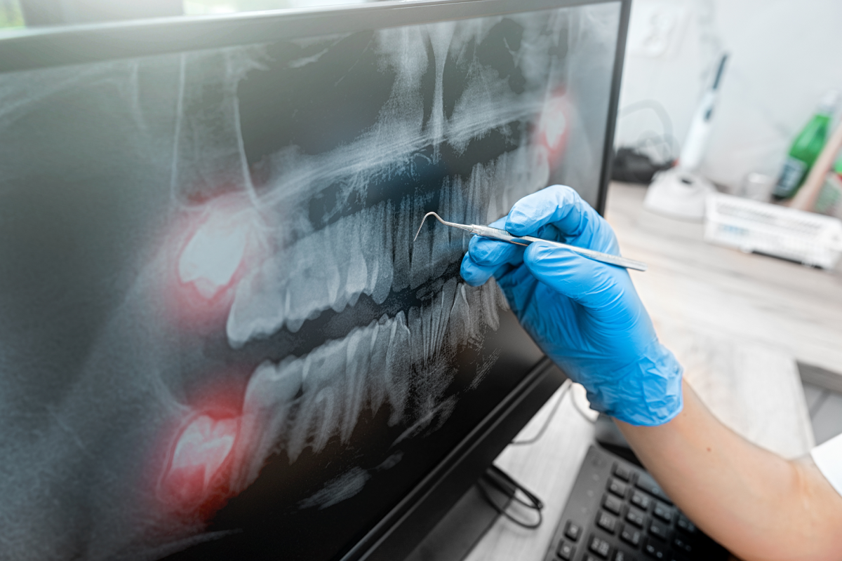 Diş Radyolojisi ve Görüntüleme