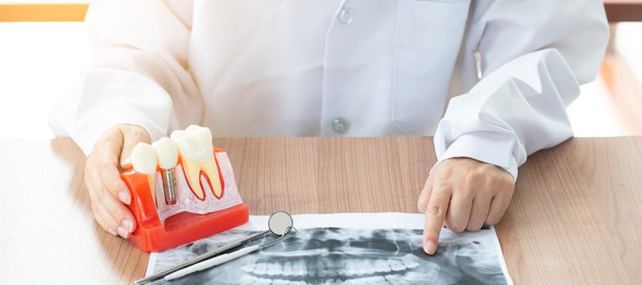 Kimlere İmplant uygulanabilir? Kimlere İmplant uygulanabilir?