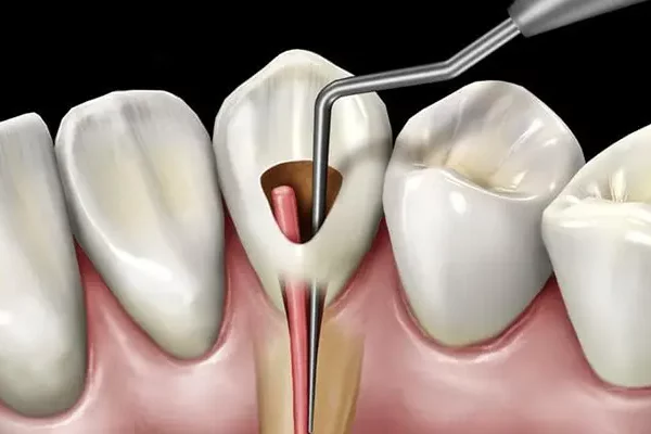 Endodontie