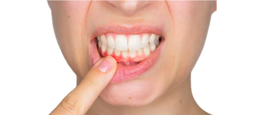 Periodontoloji Periodontoloji