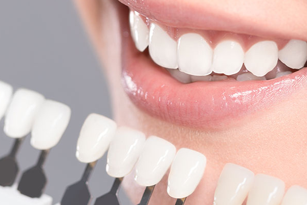Zirkonium-Veneers