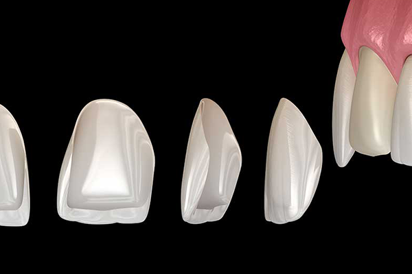Facings